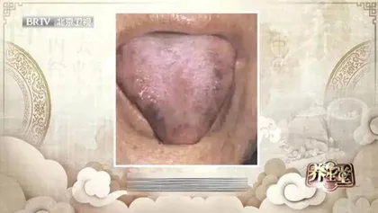活血通络治痹证1