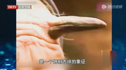 小心身上长“福痣”2