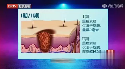 小心身上长“福痣”5