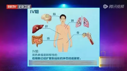 小心身上长“福痣”7