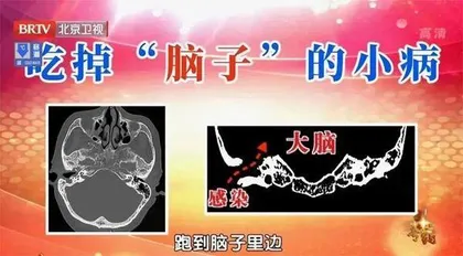 警惕“吃掉”大脑的小毛病2