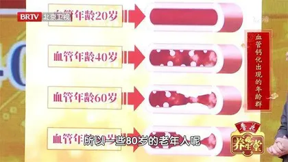 警惕血管钙化, 别让自己变得“铁石心肠”3