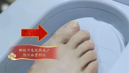 警惕血管钙化, 别让自己变得“铁石心肠”4