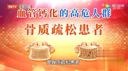 警惕血管钙化, 别让自己变得“铁石心肠”5