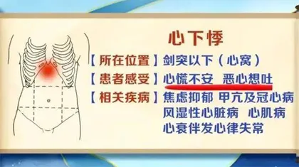 巧辨心悸识心病3