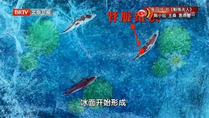小心急性肾损伤盯上老年人4
