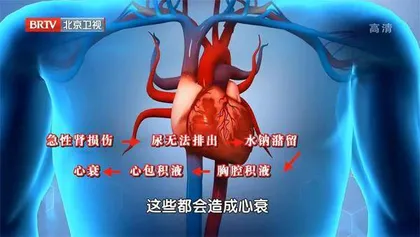 小心急性肾损伤盯上老年人6