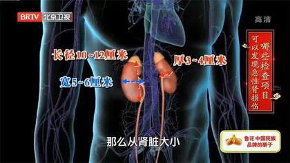 小心急性肾损伤盯上老年人8