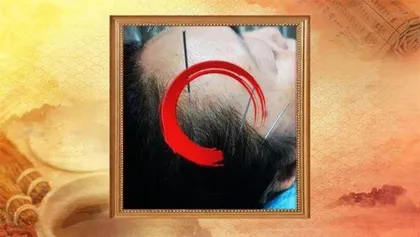 透过浮络望健康3