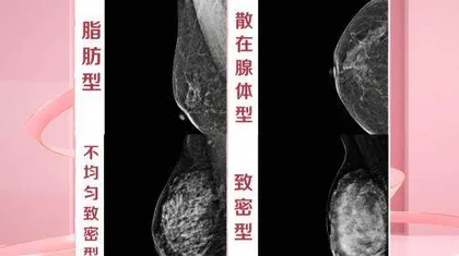 女性防癌从“调节器”入手2