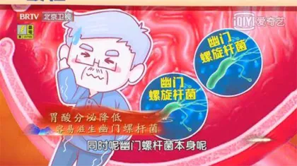 胃酸过低癌敲门6