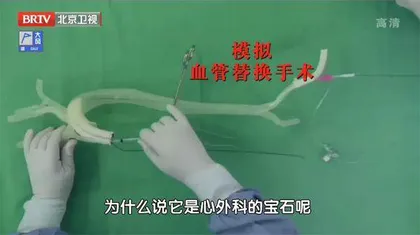 凶险的主动脉夹层3