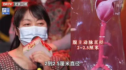 凶险的主动脉夹层4