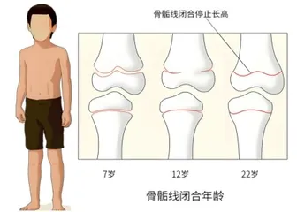 儿童骨龄评估
