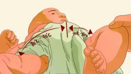 髋关节发育不良的防治措施1