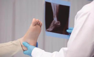青春期骨骼发育,影像学检查知多少2