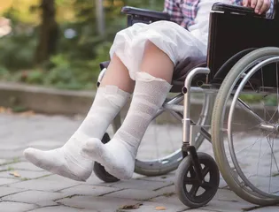 青少年急性骨折的治疗1