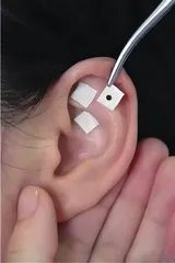 中医耳穴压丸疗法为青少年减压助眠