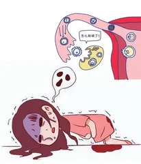 青春期女性需要警惕黄体破裂