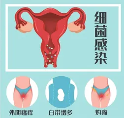 青春期女性如何预防阴道炎？