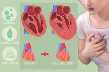 青少年如何预防心肌炎?