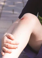 青少年外伤性骨折的康复锻炼