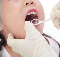 如何在青少年牙齿矫正期间保护牙齿健康