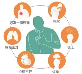 青少年气胸的防治