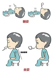 青少年气胸的防治1