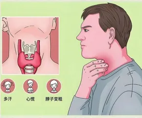 认识甲状腺和甲状腺功能异常1