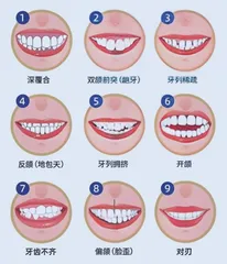青少年错颌畸形的危害与矫正