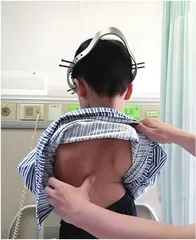 警惕脊柱侧弯危害青少年健康
