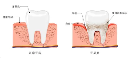 年纪轻轻也会掉牙