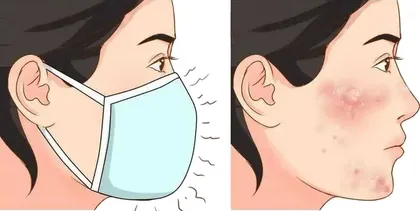 寒冬里养护皮肤莫儿戏