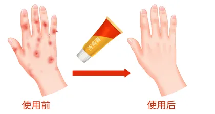 寒冬里养护皮肤莫儿戏1