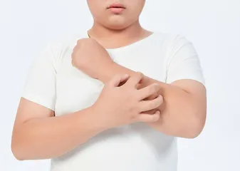 浅谈青少年皮肤健康问题