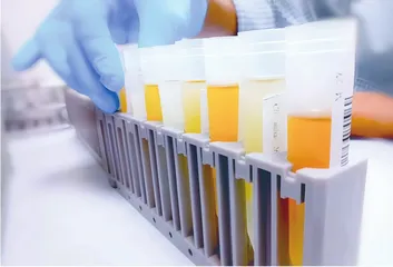 儿童尿常规检查报告解读