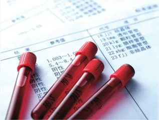 儿童血常规检验报告这些重点要看！
