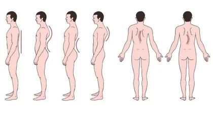 想让脊柱挺拔如松，试试这4招1
