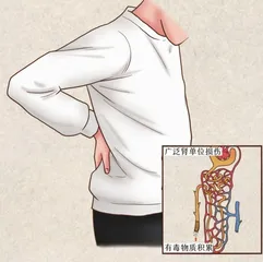 血液透析为尿毒症患儿打开生命通道