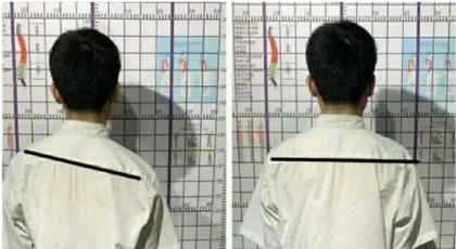 青少年脊柱侧弯的识别与简单干预和治疗1