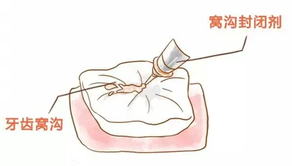 青少年口腔健康知识3