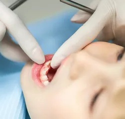 磕坏了牙齿怎么办？1