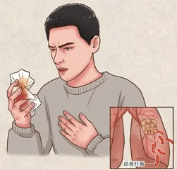 青少年肺结核之我见1