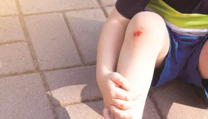 如何预防和处理青少年常见的运动损伤