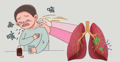 儿童结核病应如何防治？