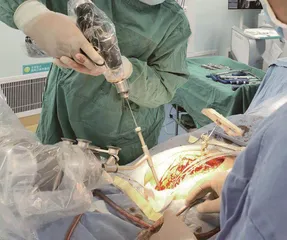青少年脊柱侧弯的预防和治疗1
