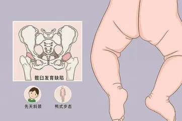 青少年髋关节发育不良如何进行康复训练？
