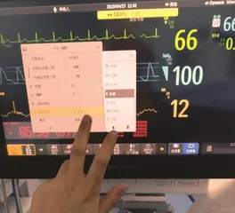 麻醉复苏室的作用与护理