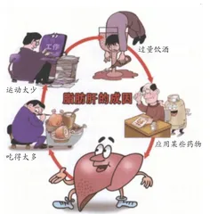 脂肪肝的营养治疗1